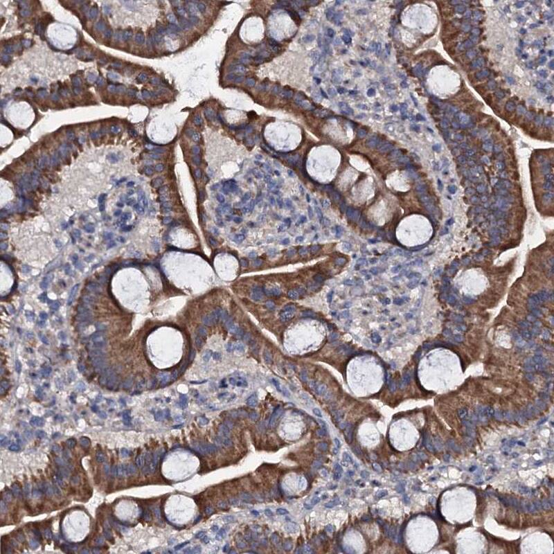 Glucuronic Acid Epimerase Antibody - BSA Free Immunohistochemistry-Paraffin: Glucuronic Acid Epimerase Antibody [NBP2-31985]