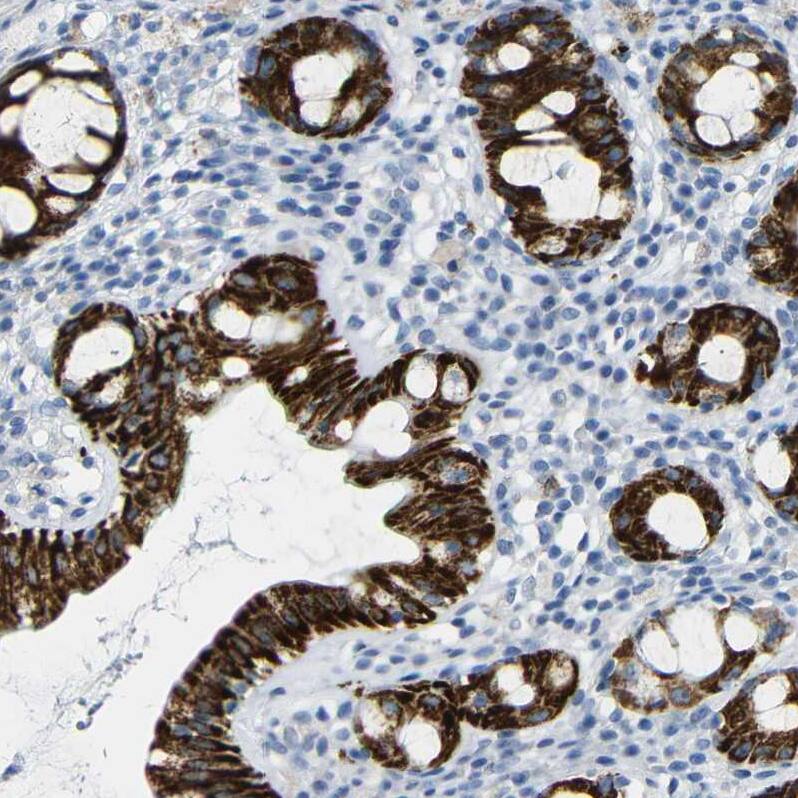 NMES1 Antibody Immunohistochemistry-Paraffin: NMES1 Antibody [NBP2-31996]