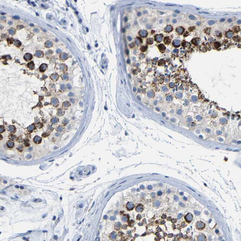 NMES1 Antibody Immunohistochemistry-Paraffin: NMES1 Antibody [NBP2-31996]