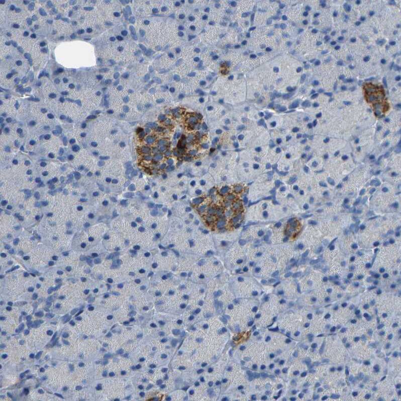 NMES1 Antibody Immunohistochemistry-Paraffin: TCL1A Antibody [NBP2-31996]