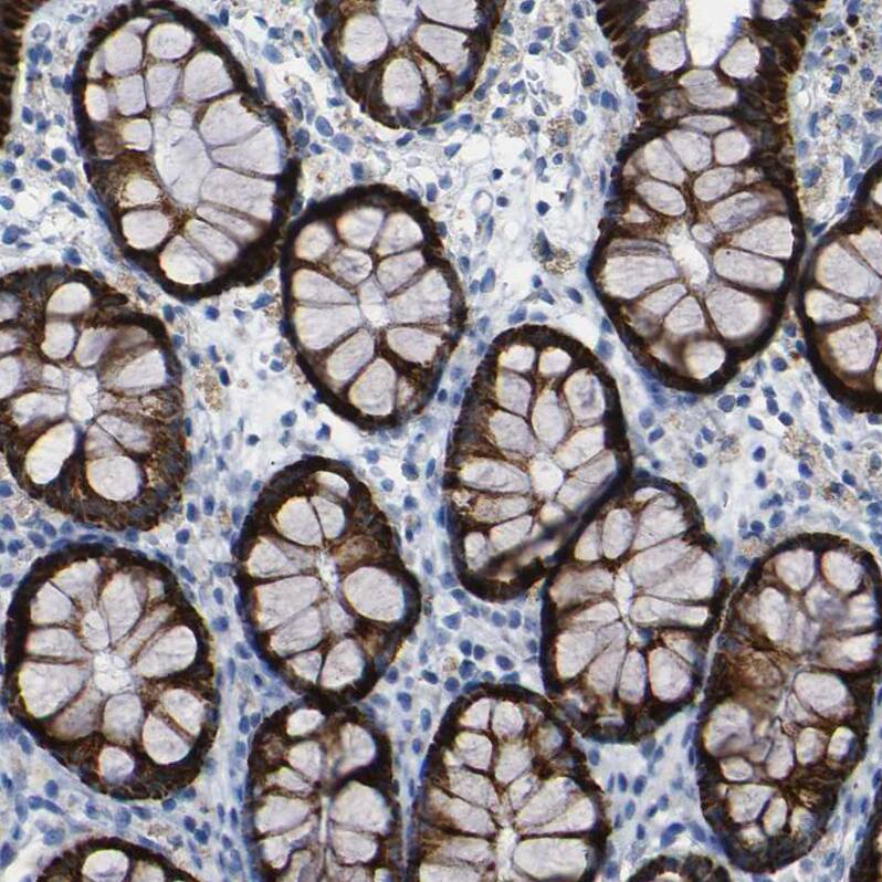 NMES1 Antibody Immunohistochemistry-Paraffin: NMES1 Antibody [NBP2-31996]
