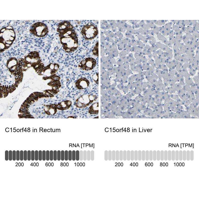 NMES1 Antibody Immunohistochemistry-Paraffin: NMES1 Antibody [NBP2-31996]