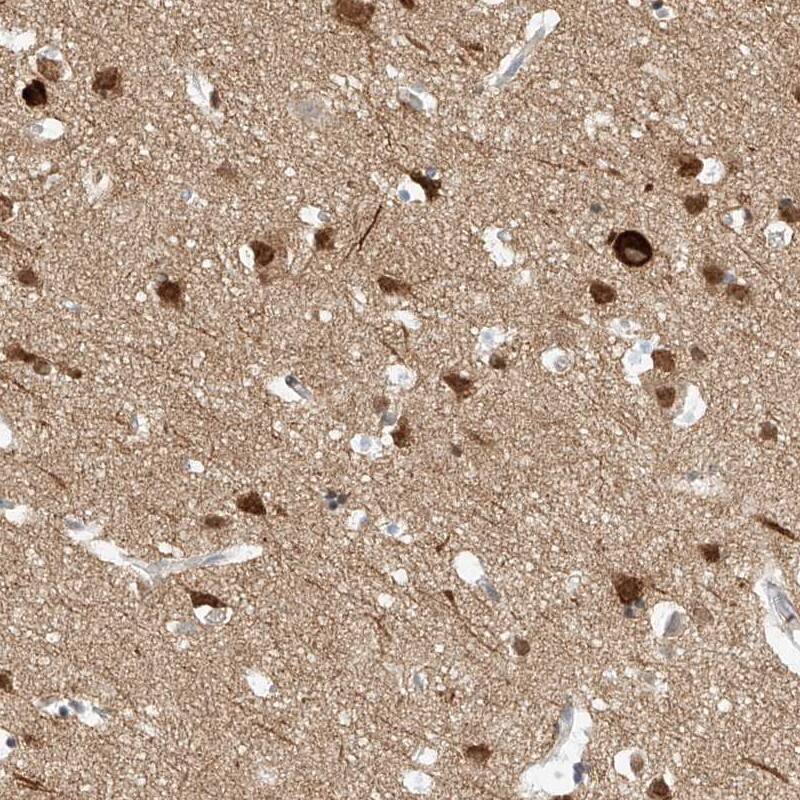 REEP2 Antibody - BSA Free Immunohistochemistry: REEP2 Antibody - BSA Free [NBP2-32017]