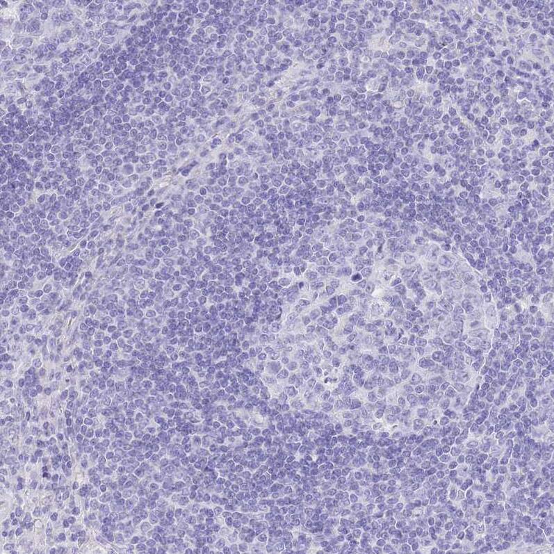 SLC4A4 Antibody - BSA Free Immunohistochemistry-Paraffin: SLC4A4 Antibody [NBP2-32020]