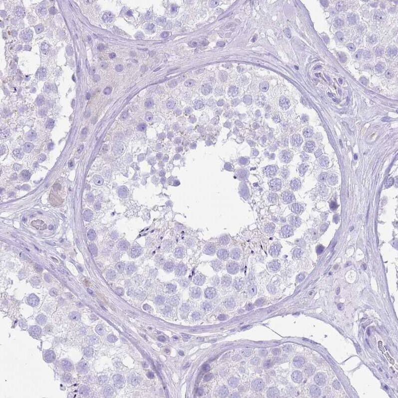 SLC4A4 Antibody - BSA Free Immunohistochemistry-Paraffin: SLC4A4 Antibody [NBP2-32020]