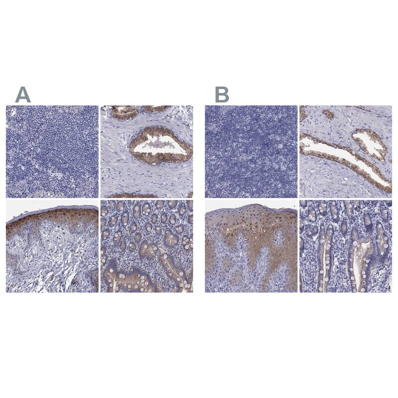 Cytosolic Sulfotransferase 2B1/SULT2B1 Antibody Immunohistochemistry-Paraffin: Cytosolic Sulfotransferase 2B1/SULT2B1 Antibody Antibody [NBP2-32596]
