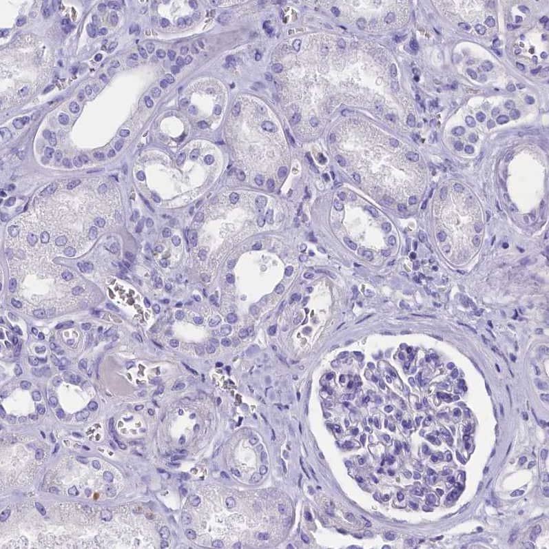 Cytosolic Sulfotransferase 2A1/SULT2A1 Antibody - BSA Free Immunohistochemistry-Paraffin: Cytosolic Sulfotransferase 2A1/SULT2A1 Antibody [NBP2-32604]