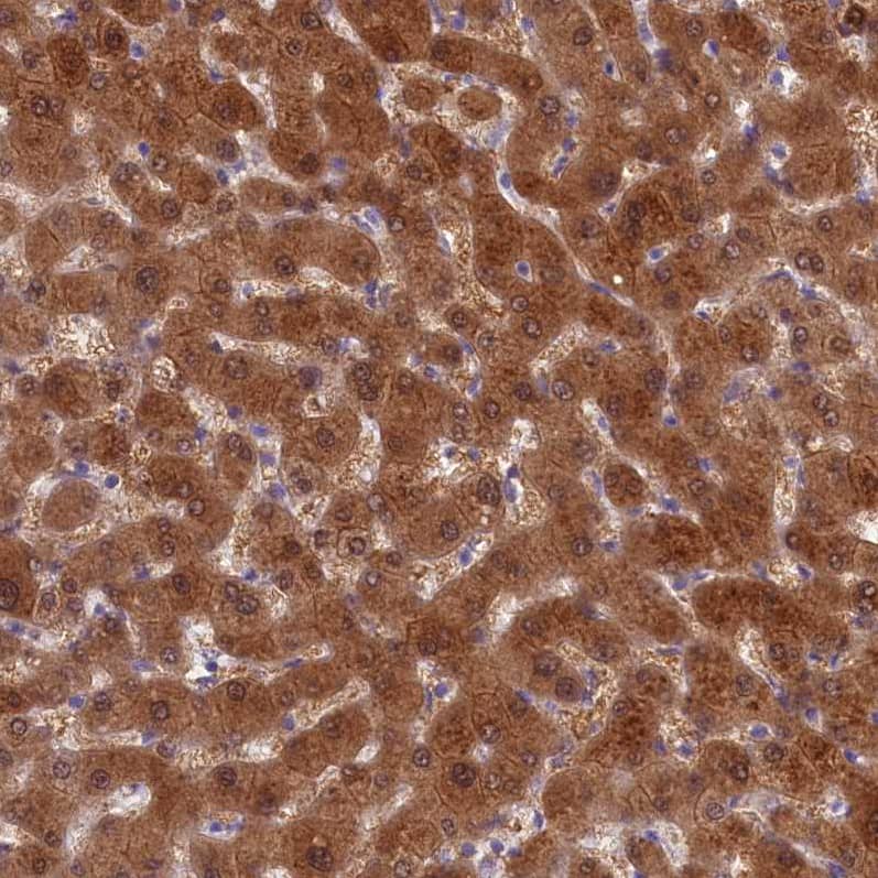 Cytosolic Sulfotransferase 2A1/SULT2A1 Antibody - BSA Free Immunohistochemistry-Paraffin: Cytosolic Sulfotransferase 2A1/SULT2A1 Antibody [NBP2-32604]