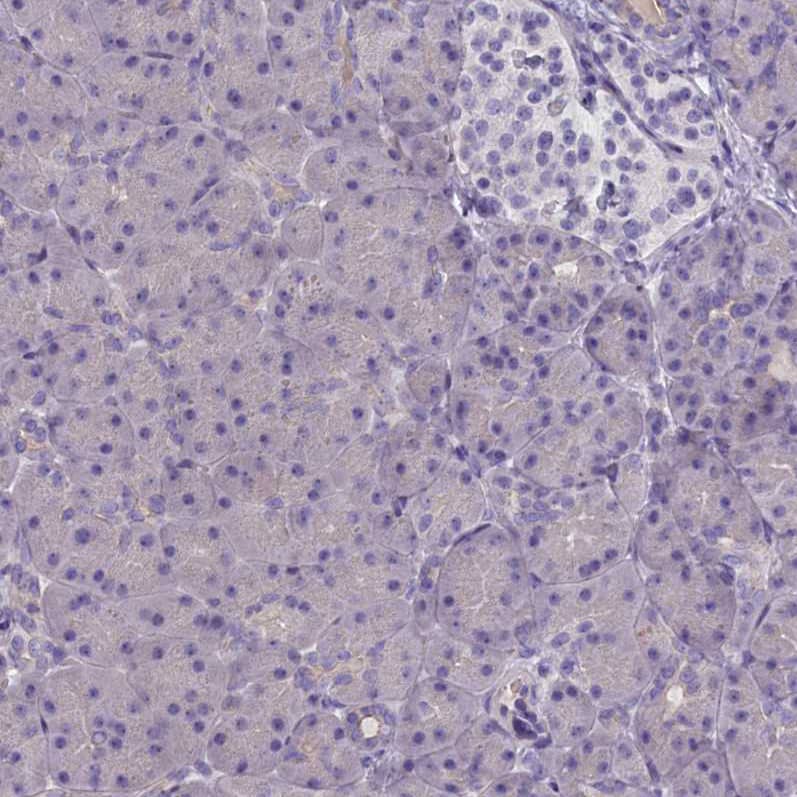 Cytosolic Sulfotransferase 2A1/SULT2A1 Antibody - BSA Free Immunohistochemistry-Paraffin: Cytosolic Sulfotransferase 2A1/SULT2A1 Antibody [NBP2-32604]