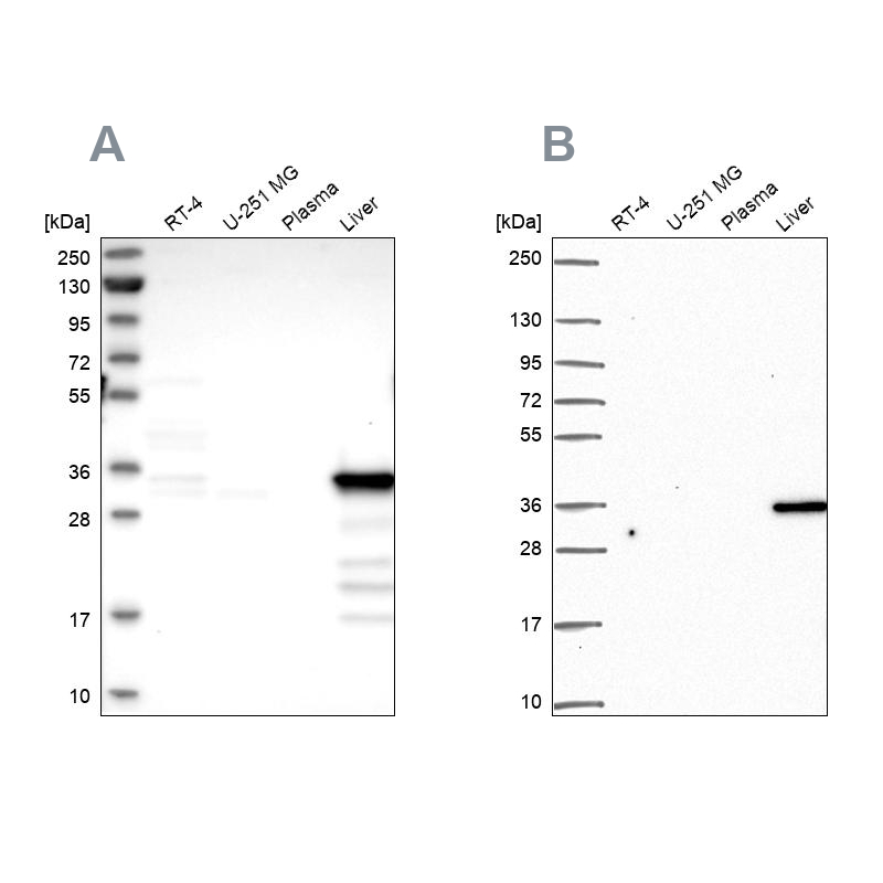 Cytosolic Sulfotransferase 2A1/SULT2A1 Antibody Western Blot: Cytosolic Sulfotransferase 2A1/SULT2A1 Antibody Antibody [NBP2-32604]