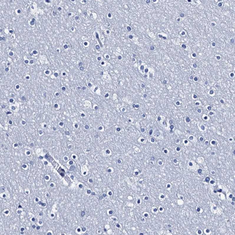 C4.4A/LYPD3 Antibody - BSA Free Immunohistochemistry-Paraffin: C4.4A/LYPD3 Antibody [NBP2-32605]
