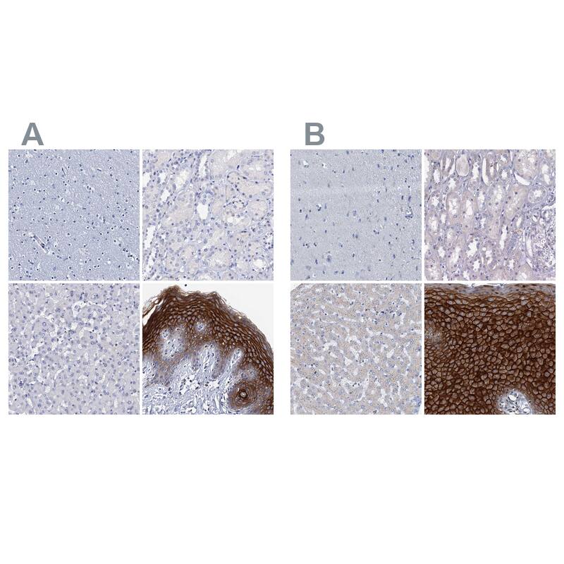 C4.4A/LYPD3 Antibody - BSA Free Immunohistochemistry-Paraffin: C4.4A/LYPD3 Antibody [NBP2-32605]