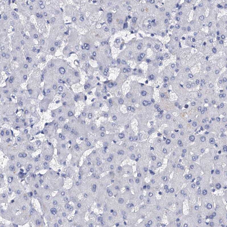C4.4A/LYPD3 Antibody - BSA Free Immunohistochemistry-Paraffin: C4.4A/LYPD3 Antibody [NBP2-32605]