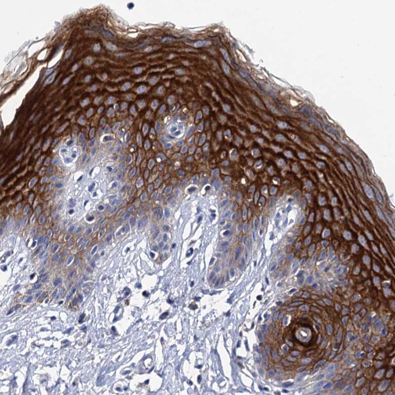 C4.4A/LYPD3 Antibody - BSA Free Immunohistochemistry-Paraffin: C4.4A/LYPD3 Antibody [NBP2-32605]