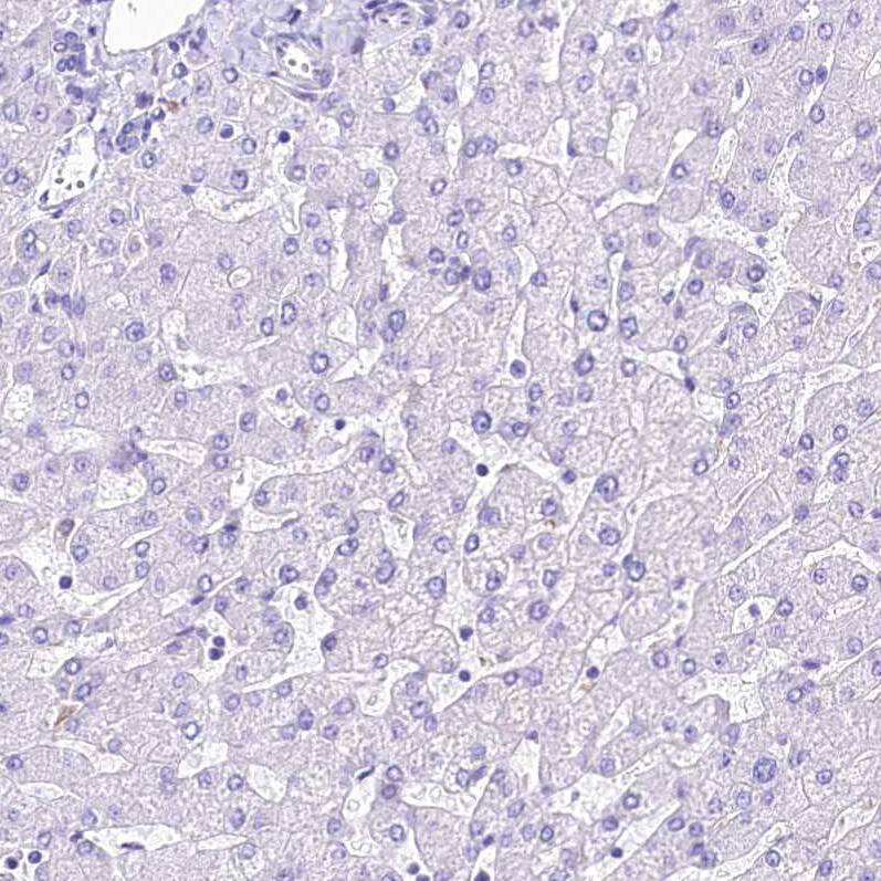 alpha 2-Macroglobulin-like 1/A2ML1 Antibody - BSA Free Immunohistochemistry-Paraffin: alpha 2-Macroglobulin-like 1/A2ML1 Antibody [NBP2-32647]