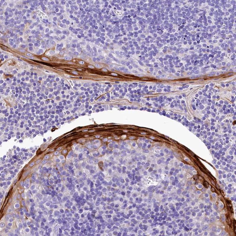 alpha 2-Macroglobulin-like 1/A2ML1 Antibody - BSA Free Immunohistochemistry-Paraffin: alpha 2-Macroglobulin-like 1/A2ML1 Antibody [NBP2-32647]