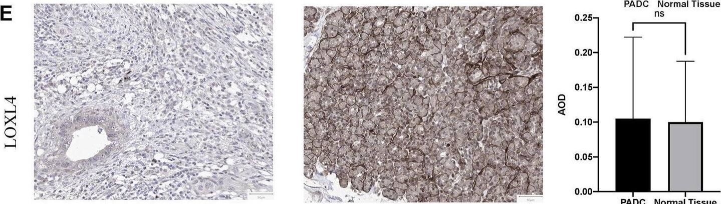 LOXL4 Antibody - BSA Free
