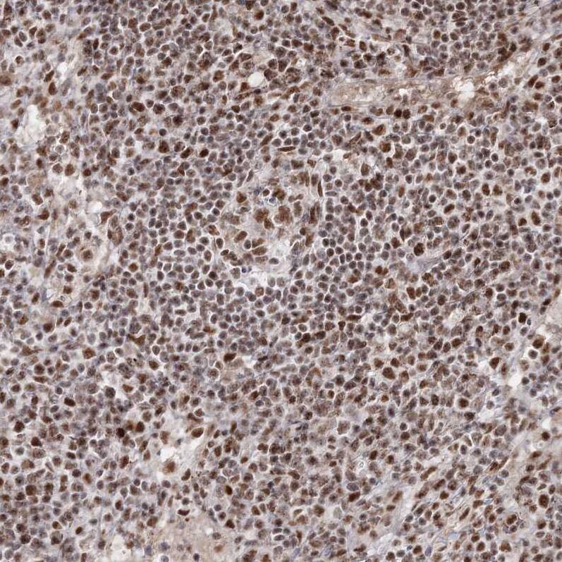 QRICH1 Antibody - BSA Free Immunohistochemistry-Paraffin: QRICH1 Antibody [NBP2-32693]