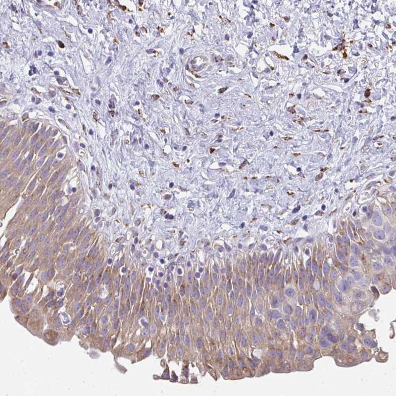 SHROOM1 Antibody - BSA Free Immunohistochemistry-Paraffin: SHROOM1 Antibody [NBP2-32696]