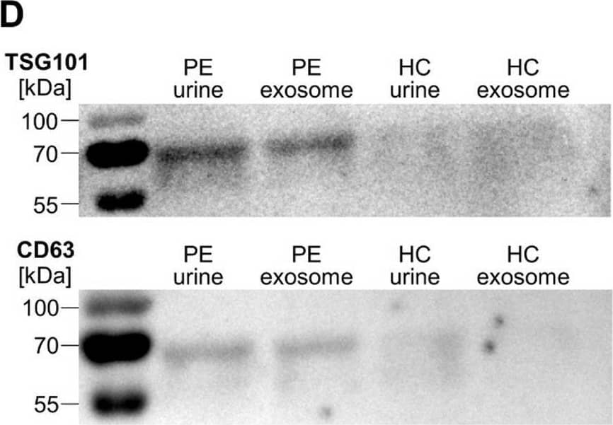 CD63 Antibody (MX-49.129.5)