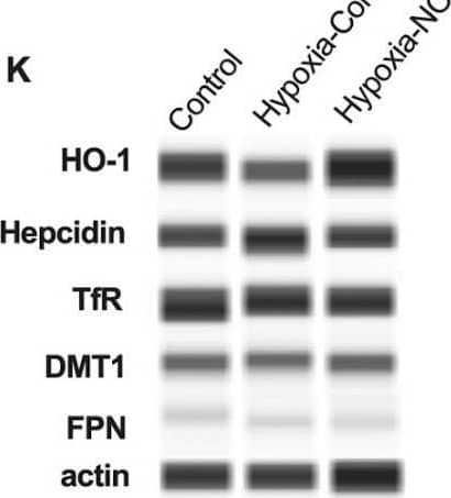 TfR (Transferrin R) Antibody (DF1513)