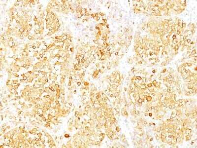 Melan-A/MART-1 Antibody (SPM540)