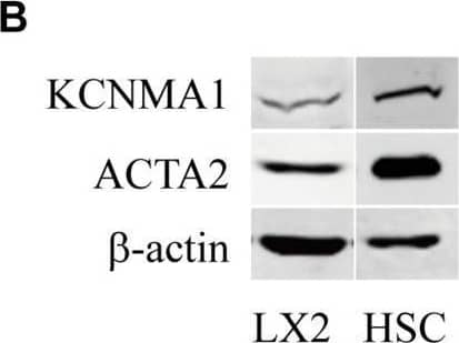 alpha-Smooth Muscle Actin Antibody (1A4/asm-1) - BSA Free