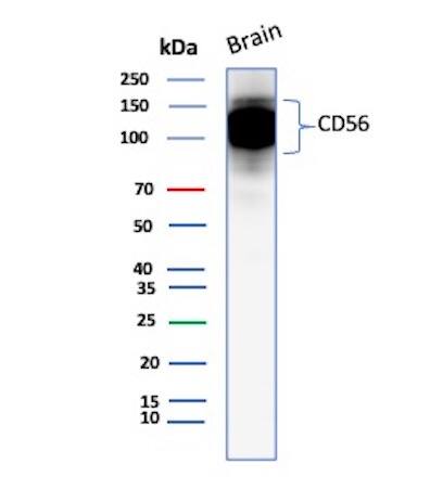 NCAM-1/CD56 Antibody (123C3.D5) - Azide and BSA Free Western Blot: NCAM-1/CD56 Antibody (123C3.D5) - Azide and BSA Free [NBP2-33132] -