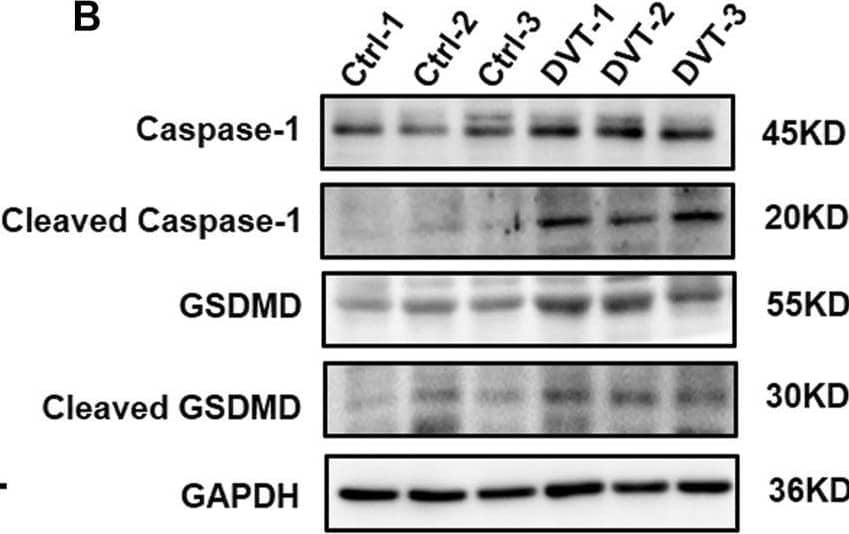 GSDMDC1 Antibody