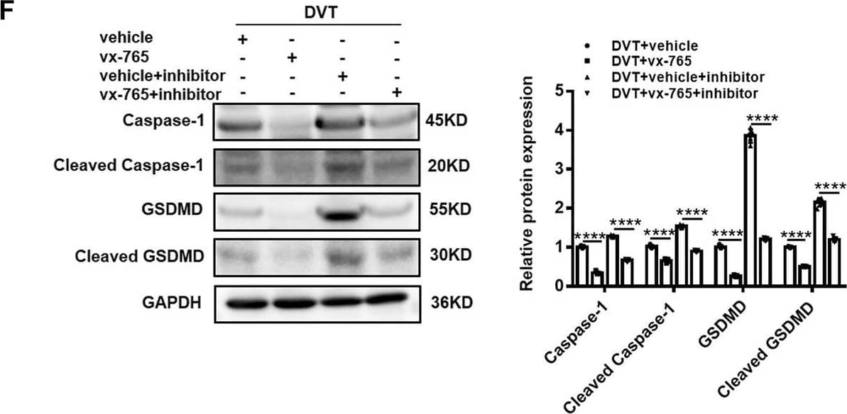 GSDMDC1 Antibody