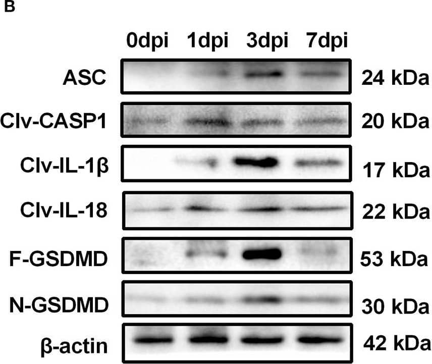 GSDMDC1 Antibody