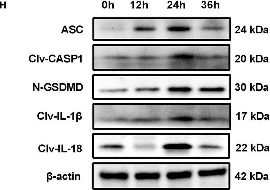 GSDMDC1 Antibody