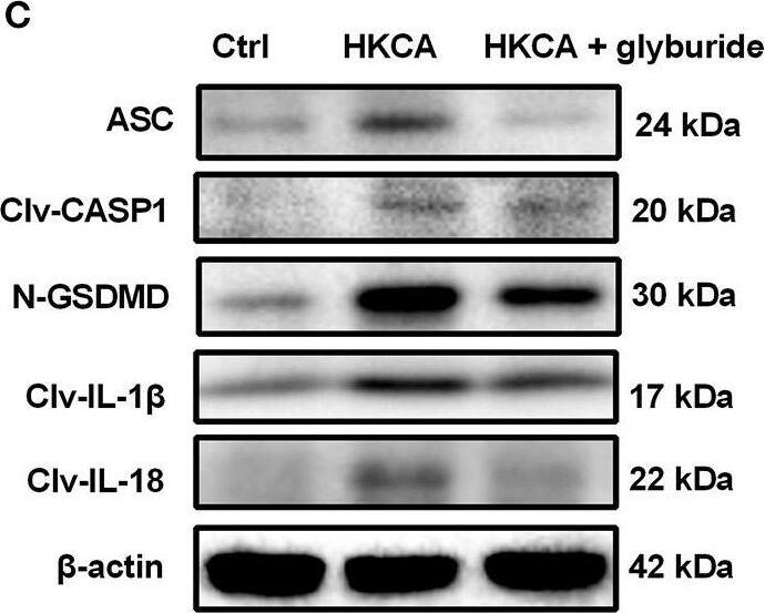 GSDMDC1 Antibody