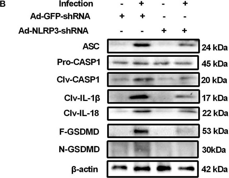 GSDMDC1 Antibody