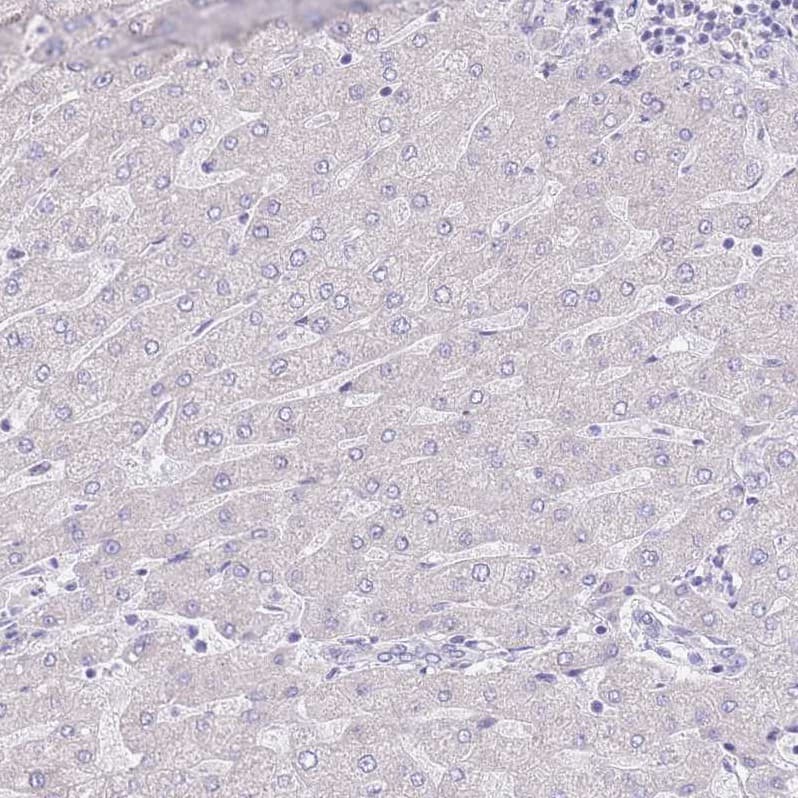 PSG4 Antibody Immunohistochemistry-Paraffin: PSG4 Antibody [NBP2-33461]