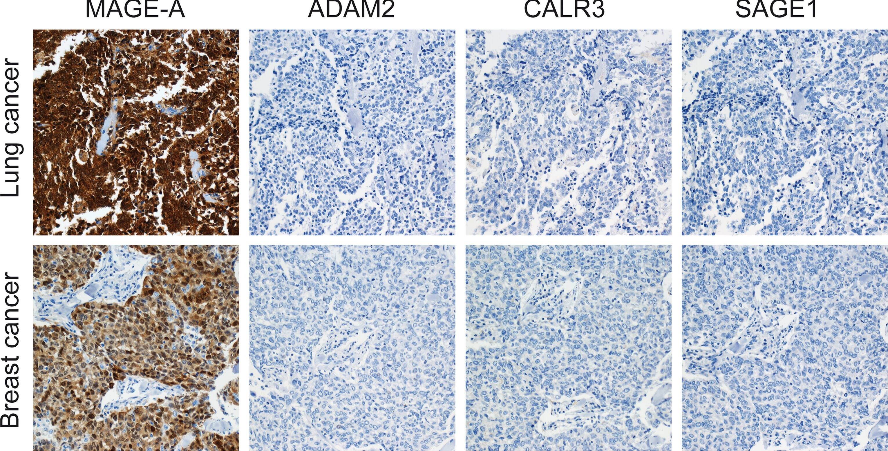 Calreticulin-2/CALR3 Antibody