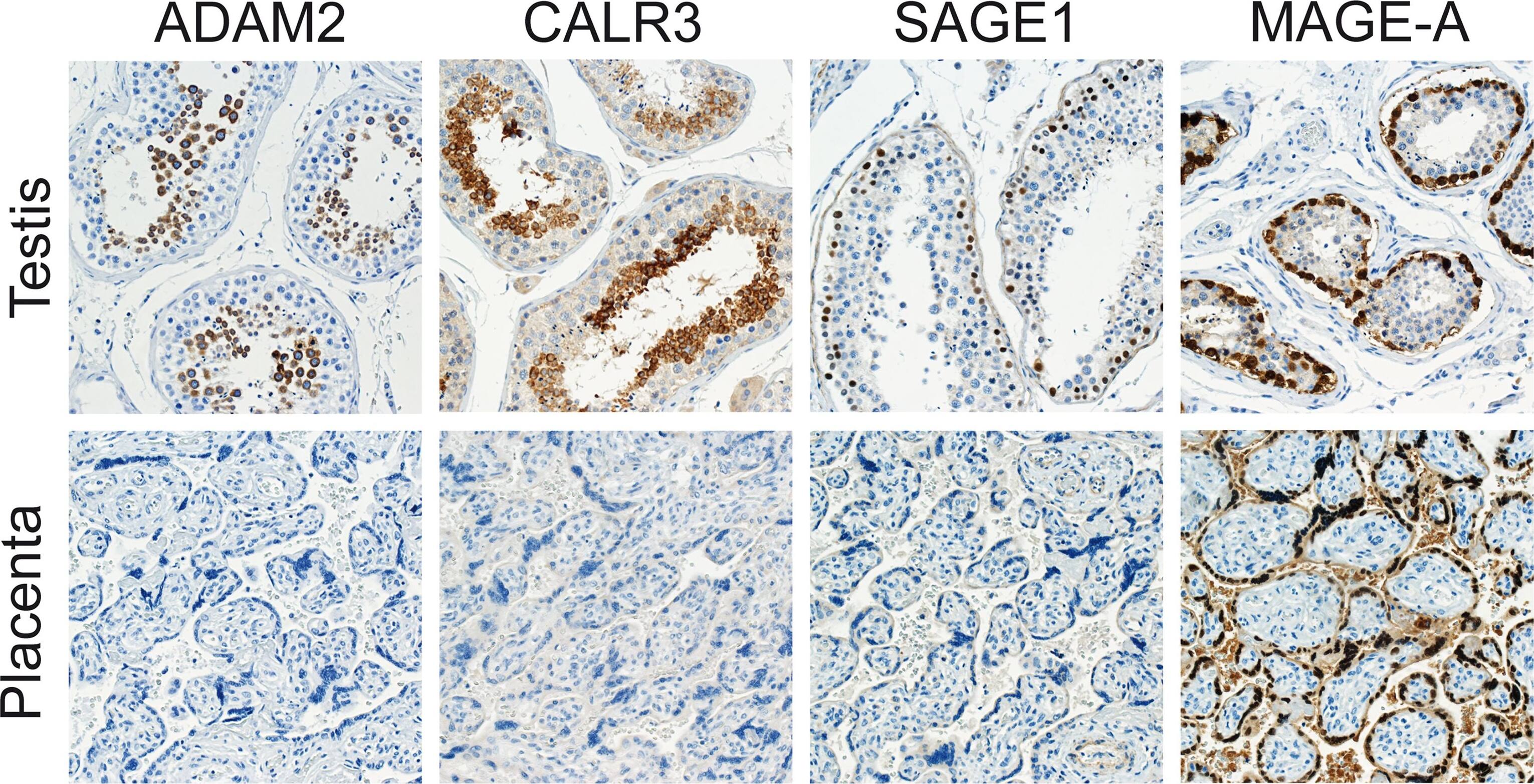 Calreticulin-2/CALR3 Antibody