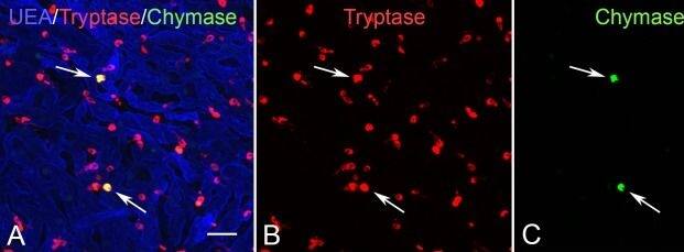 Chymase/CMA1/Mast Cell Chymase Antibody