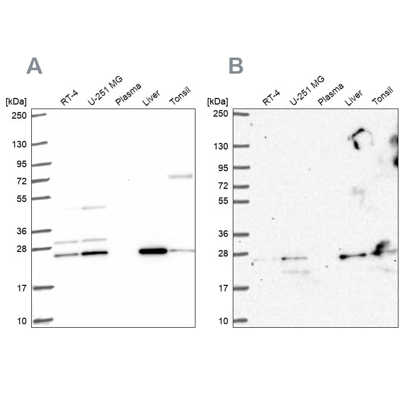 CMP kinase Antibody Western Blot: CMP kinase Antibody Antibody [NBP2-33692]