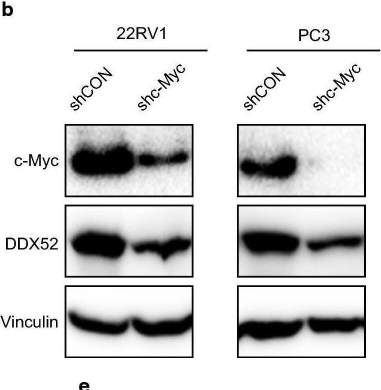 DDX52 Antibody - BSA Free