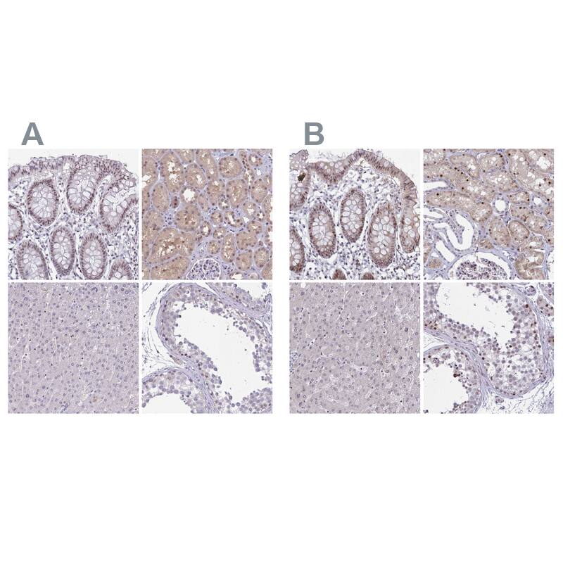 p107 Antibody Immunohistochemistry-Paraffin: p107 Antibody Antibody [NBP2-33791]