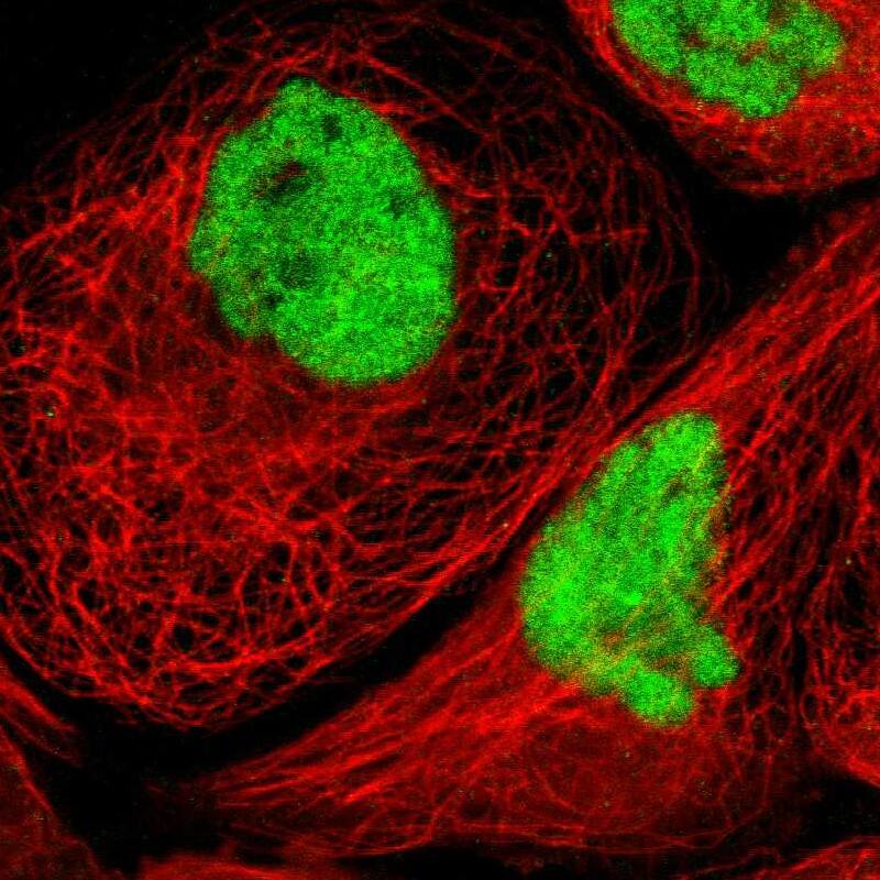 CTCF Antibody - BSA Free Immunocytochemistry/ Immunofluorescence: CTCF Antibody [NBP2-33854]