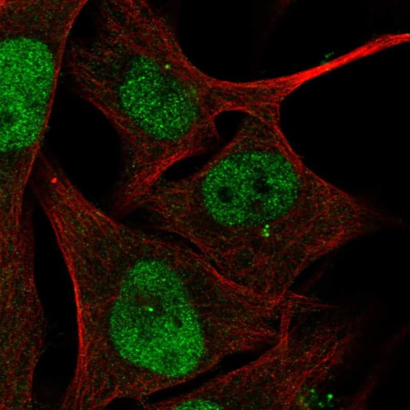 ZBTB24 Antibody - BSA Free Immunocytochemistry/ Immunofluorescence: ZBTB24 Antibody [NBP2-33856]