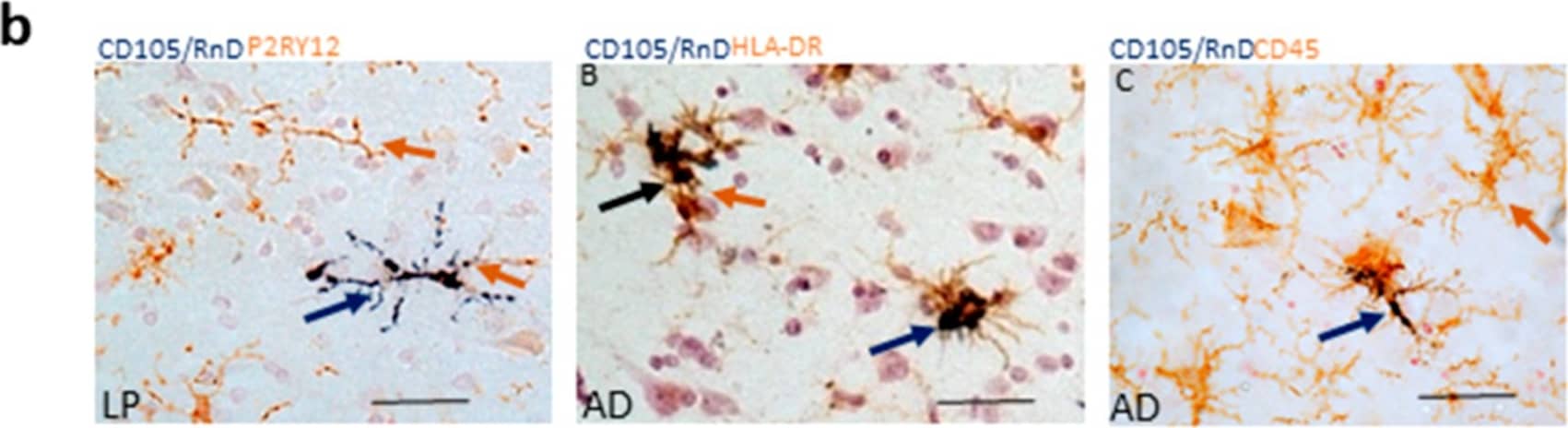 P2Y12/P2RY12 Antibody