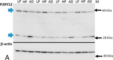 P2Y12/P2RY12 Antibody - BSA Free