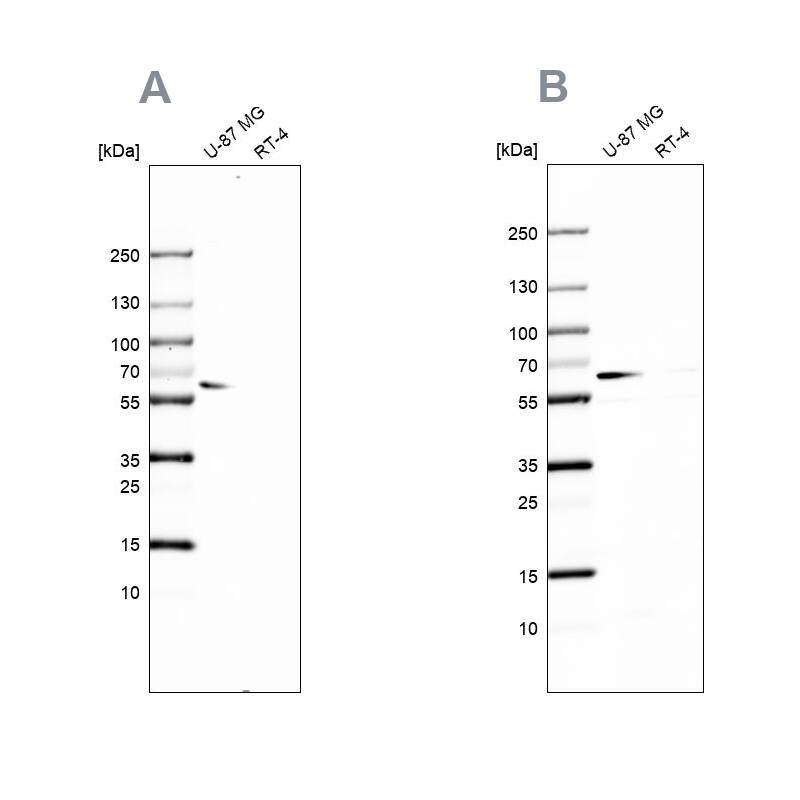 P4HA2 Antibody Western Blot: P4HA2 Antibody Antibody [NBP2-33878]