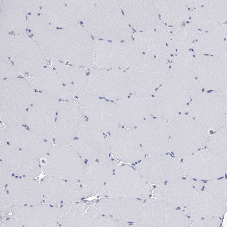 SerpinB9 Antibody - BSA Free Immunohistochemistry-Paraffin: SerpinB9 Antibody [NBP2-33924]