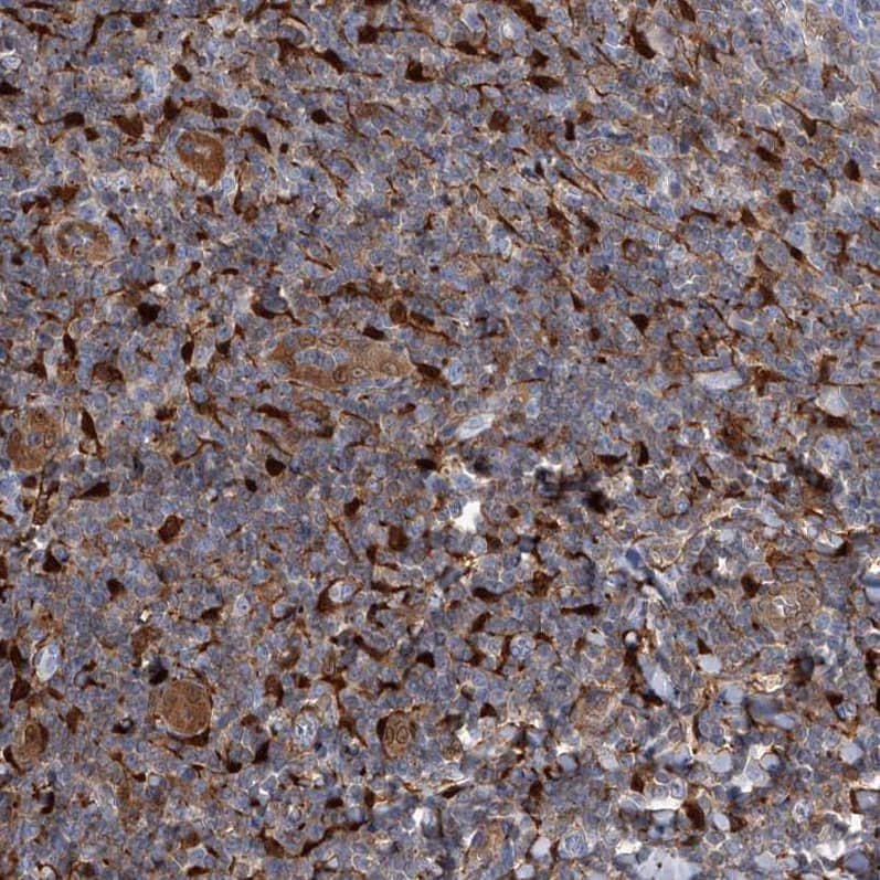 SerpinB9 Antibody - BSA Free Immunohistochemistry-Paraffin: SerpinB9 Antibody [NBP2-33924]