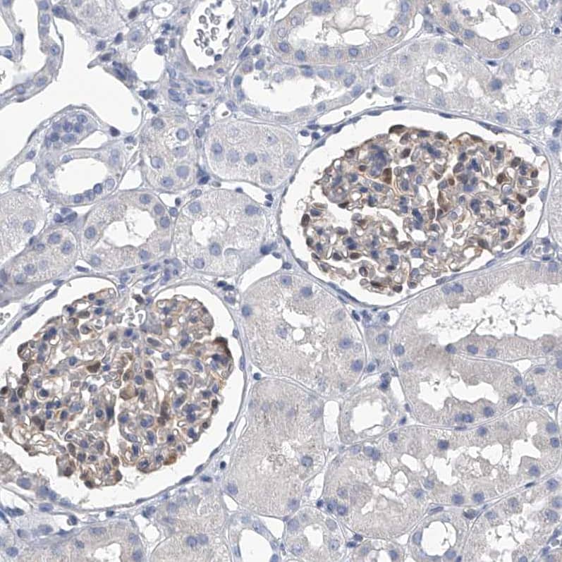 SerpinB9 Antibody - BSA Free Immunohistochemistry-Paraffin: SerpinB9 Antibody [NBP2-33924]