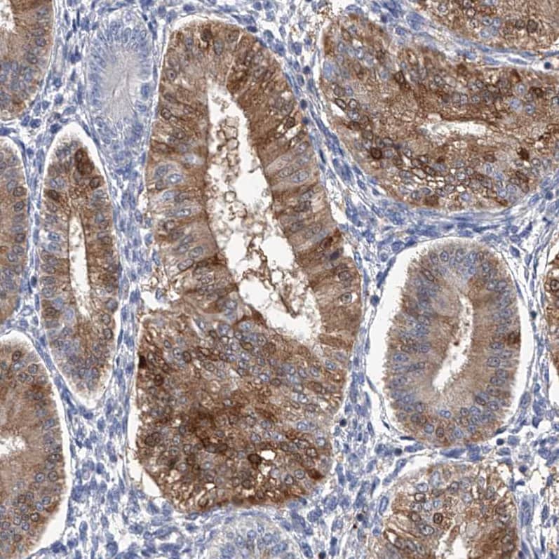 SerpinB9 Antibody - BSA Free Immunohistochemistry-Paraffin: SerpinB9 Antibody [NBP2-33924]